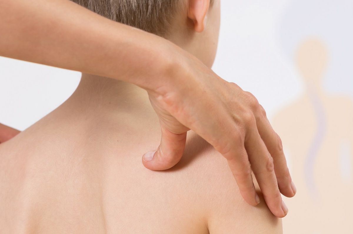 fisioterapia scoliosi alice da costa lugano 1